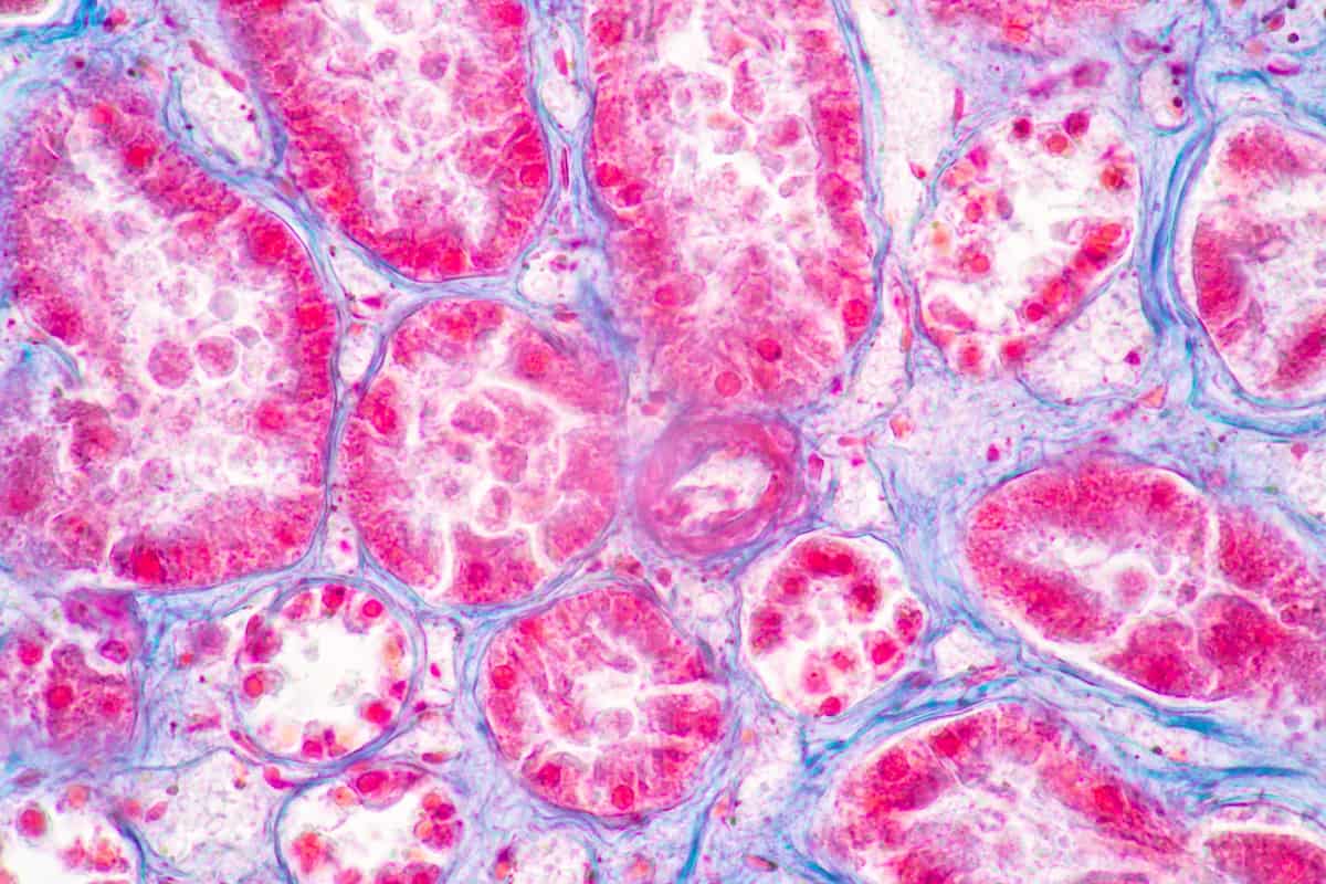 en-tête de réactivité croisée des tissus